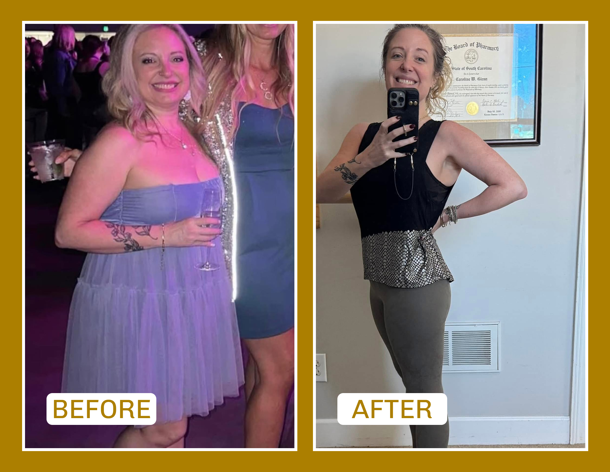 before and after